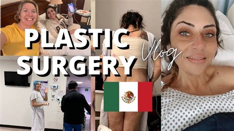 tummy tuck in tijuana cost|Tummy Tuck in Tijuana – Mexico